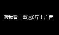 医我看丨重达6斤！广西女子乳腺肿瘤2年疯长至篮球大，医生提醒	：这些情况务必重视