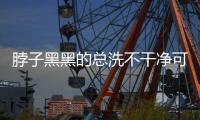脖子黑黑的总洗不干净可能是病了�，这些疾病信号赶紧自查